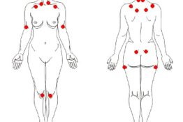 img-fibromialgia-doenca-tratada-clinica-harmony-da-dor-campo-grande