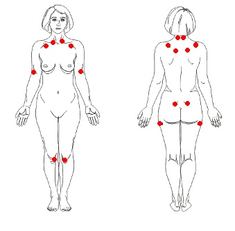 img-fibromialgia-doenca-tratada-clinica-harmony-da-dor-campo-grande